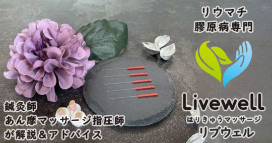 全身性エリテマトーデス（SLE）